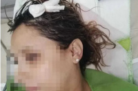 Una mujer y sus hijas quedaron heridas tras la caída del granizo: 